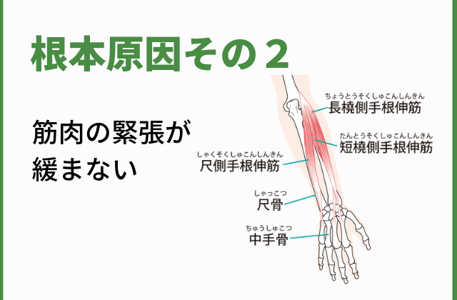 原因その２．筋肉の緊張が取れない