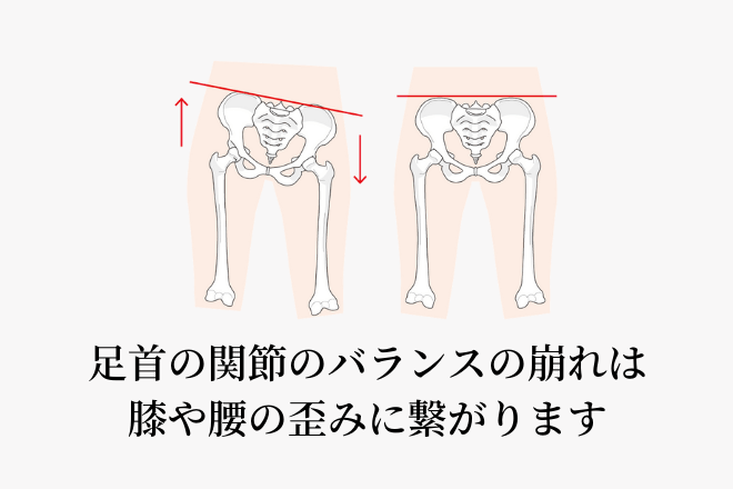 足首の捻挫が腰痛や膝の痛みの引き金になるって知っていますか 大阪の整体 創輝鍼灸整骨院