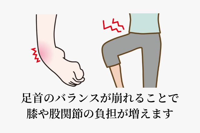 足首の捻挫の後 膝や股関節まで痛くなってしまう理由とは 大阪の整体 創輝鍼灸整骨院