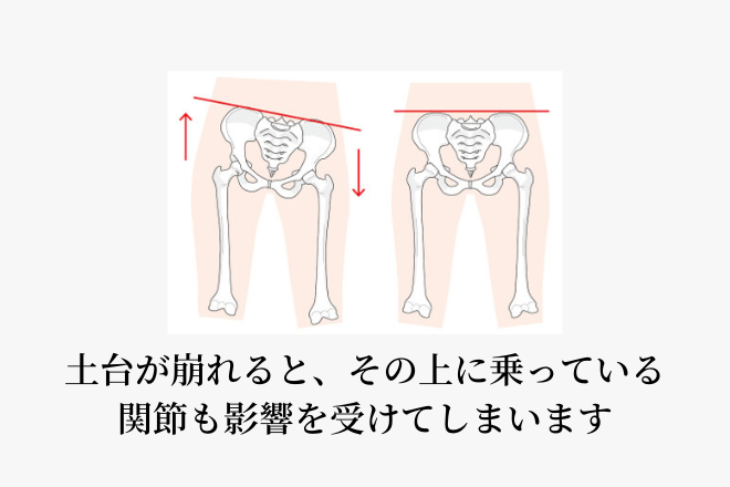 土台が崩れると、その上に乗っている関節も影響を受けてしまいます