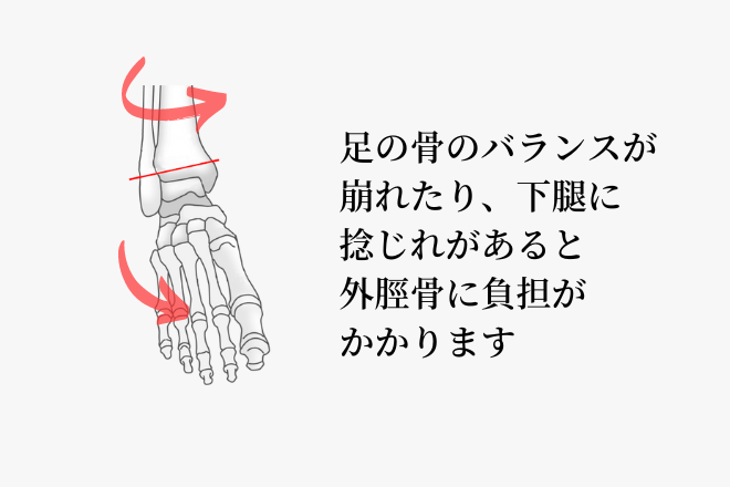 足の骨のバランスが崩れたり、下腿に捻じれがあると、外脛骨に負担がかかります