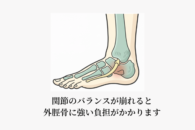 関節のバランスが崩れると外脛骨に強い負担がかかります