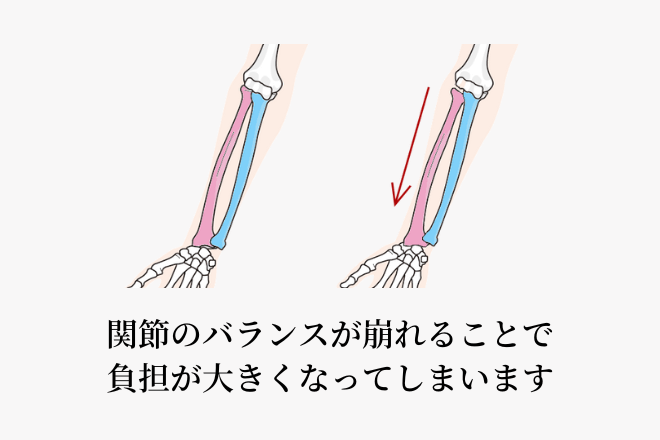 関節のバランスが崩れることで負担が大きくなってしまいます