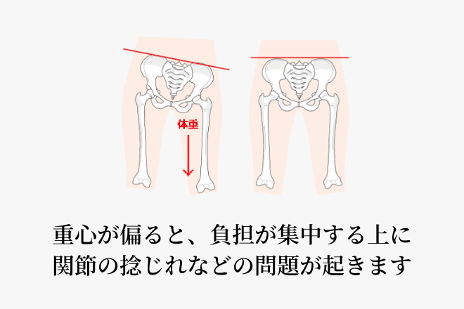重心が偏ると、負担が集中する上に関節の捻じれなどの問題が起きます