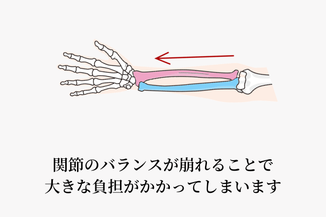 関節のバランスが崩れることで大きな負担がかかってしまいます