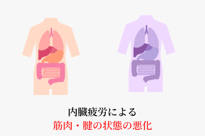 内臓疲労による筋肉・腱の状態の悪化をイメージ図に