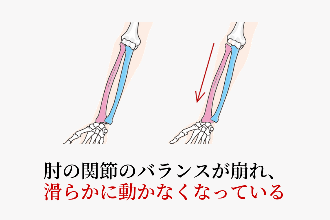 肘の関節のイラスト