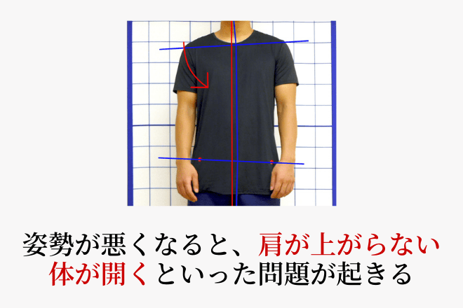 姿勢が悪くなり、全身の動きが滑らかでなくなっている