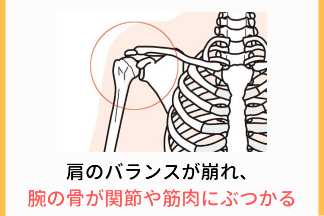 肩の関節のバランスが崩れると、骨や筋肉にぶつかってしまう