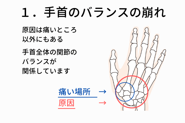 根本原因の１．手根骨のバランスの崩れ