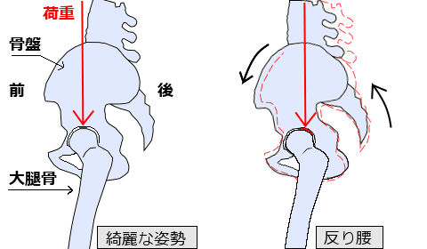 姿勢の違いによる股関節への負担