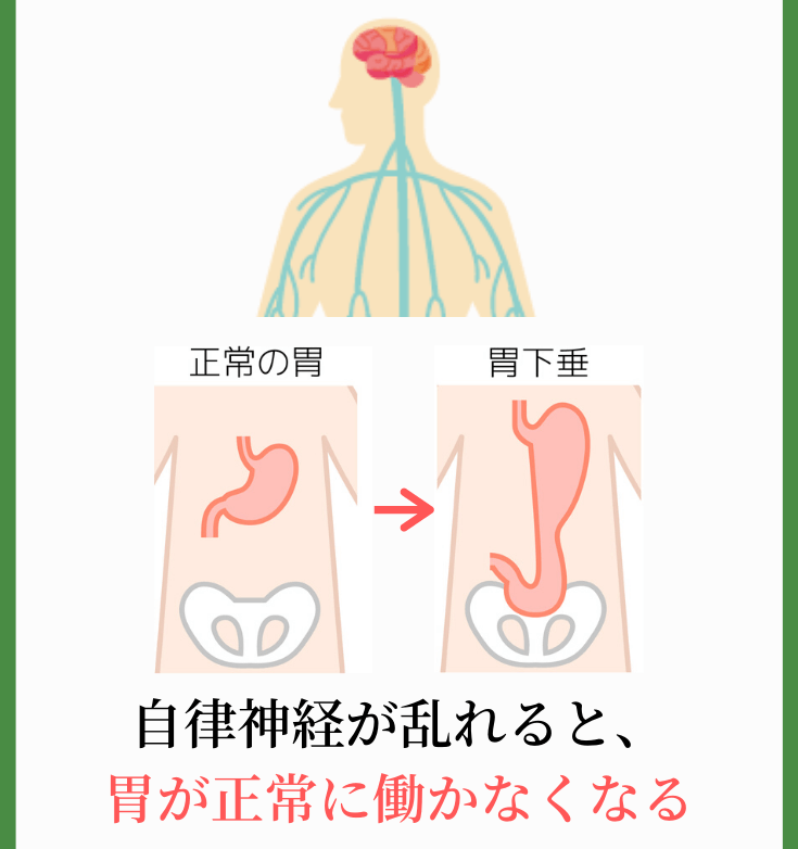 胃下垂 大阪の整体 遠方から大勢来院する創輝鍼灸整骨院