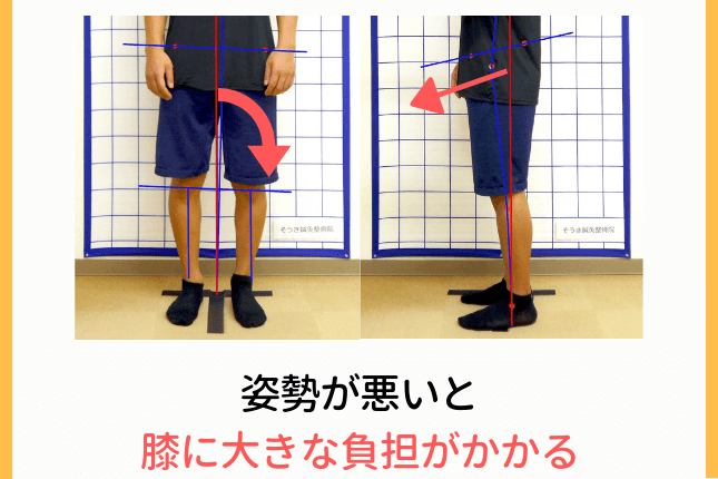 体重のかかり方の偏り
