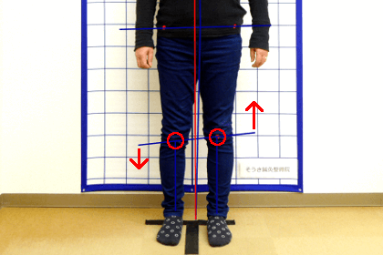 骨盤の関節のバランス
