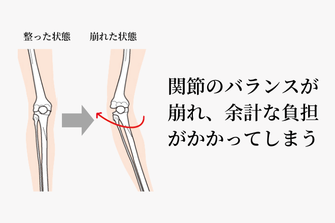 膝の関節のバランス