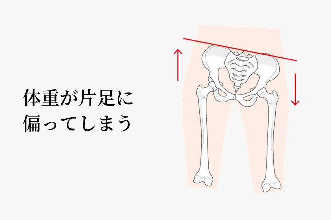 変形性膝関節症の重心の変化