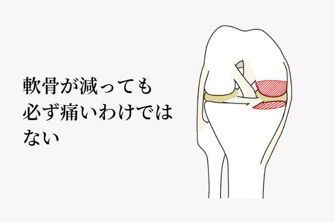 膝の関節のバランス
