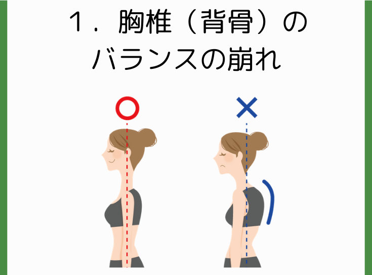 背中のカーブの増加