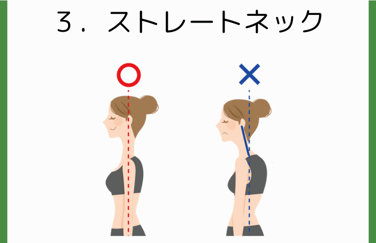 首が前に突き出たストレートネック