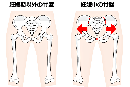 妊婦さんの腰痛 大阪の整体 遠方から大勢来院する創輝鍼灸整骨院