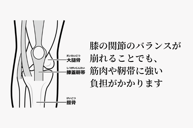 膝の関節のイラスト