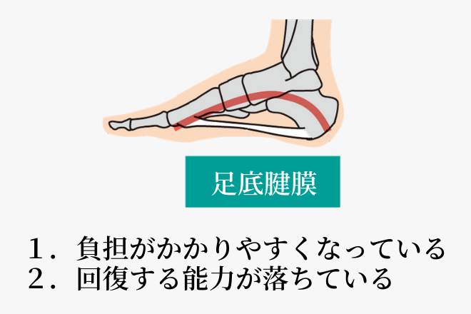 足底腱膜炎はどうして治らないのか？