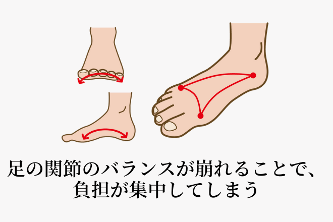 足のバランスの崩れ