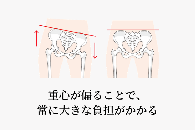 体重のかかり方の偏り