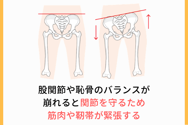 股関節のバランスの崩れ