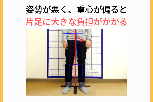 体重のかかり方の偏り