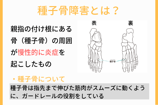 種子骨障害とは？