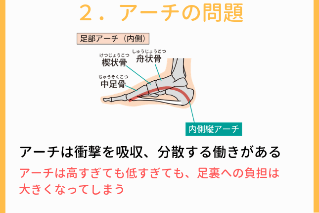 アーチの問題