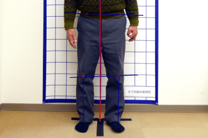 脊柱管狭窄症の原因２．姿勢の問題
