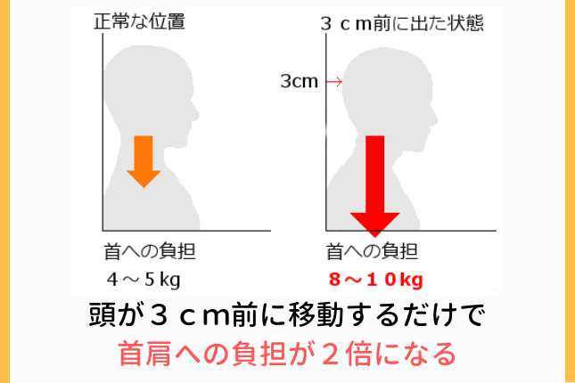 首や肩の慢性的なこり