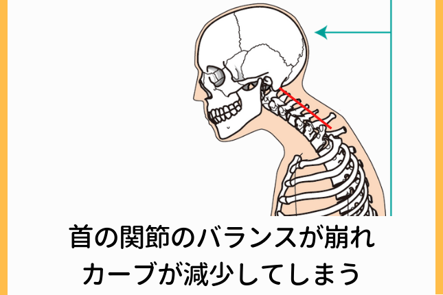 首や肩の慢性的なこり