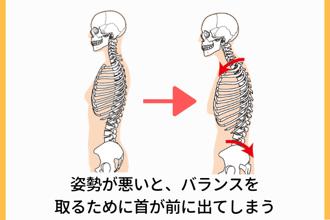 首や肩の慢性的なこり