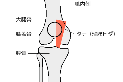 タナ障害 大阪の整体 遠方から大勢来院する創輝鍼灸整骨院