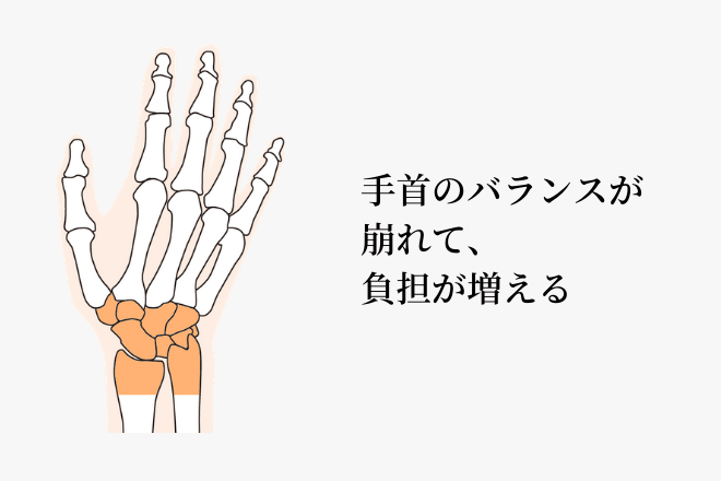 手根骨と前腕についてのイラスト