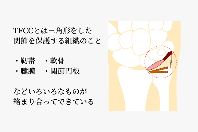 TFCCとは三角形をした関節を保護する組織のこと・靭帯・軟骨・関節円板・腱膜などいろいろなものが絡まり合ってできている