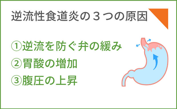 ①逆流を防ぐ弁の緩み②胃酸の増加③腹圧の上昇
