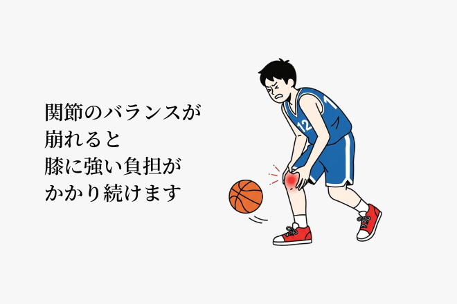 関節のバランスが崩れると膝に強い負担がかかり続けます