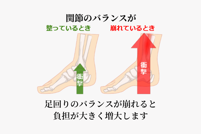 重心が偏ると、負担が集中する上に関節の捻じれなどの問題が起きます