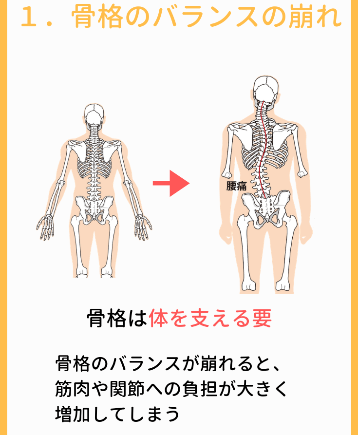 根本原因その１．骨格のバランスが崩れているから