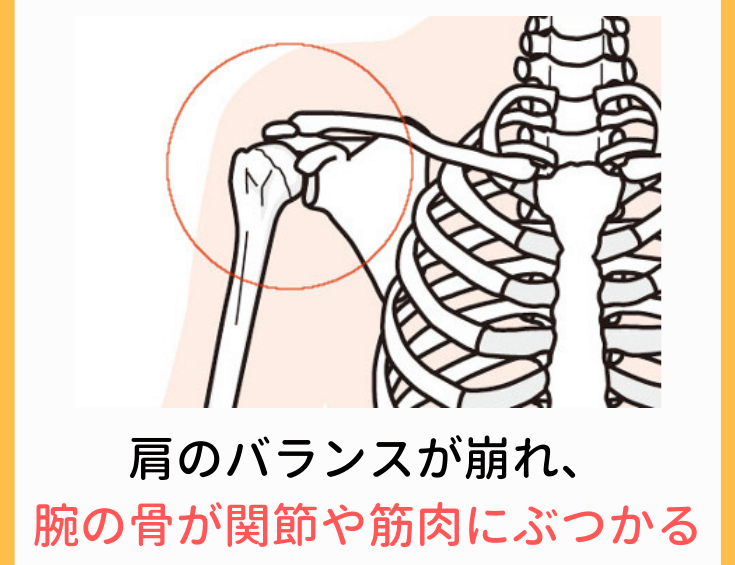 肩の関節のバランスが崩れると、骨や筋肉にぶつかってしまう