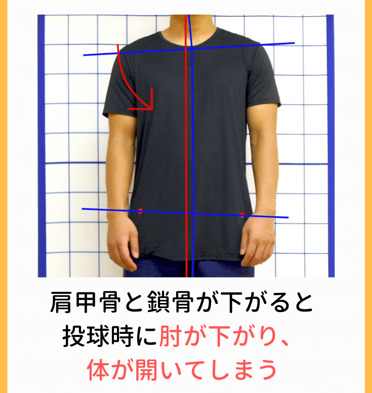 肩甲骨と鎖骨が下がると投球時に肘が下がり、体が開いてしまう
