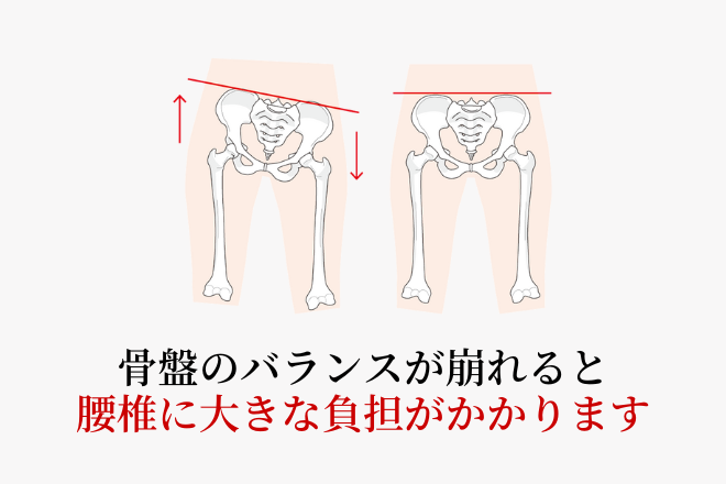 バランスが崩れた骨盤により、腰椎に負担がかかる