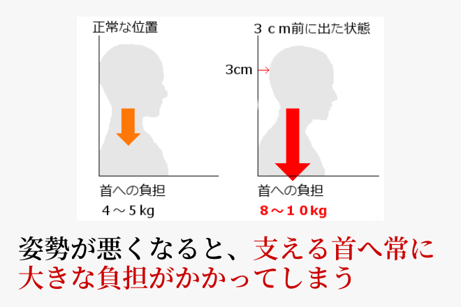 姿勢が悪くなると、支える首へ常に大きな負担がかかってしまう