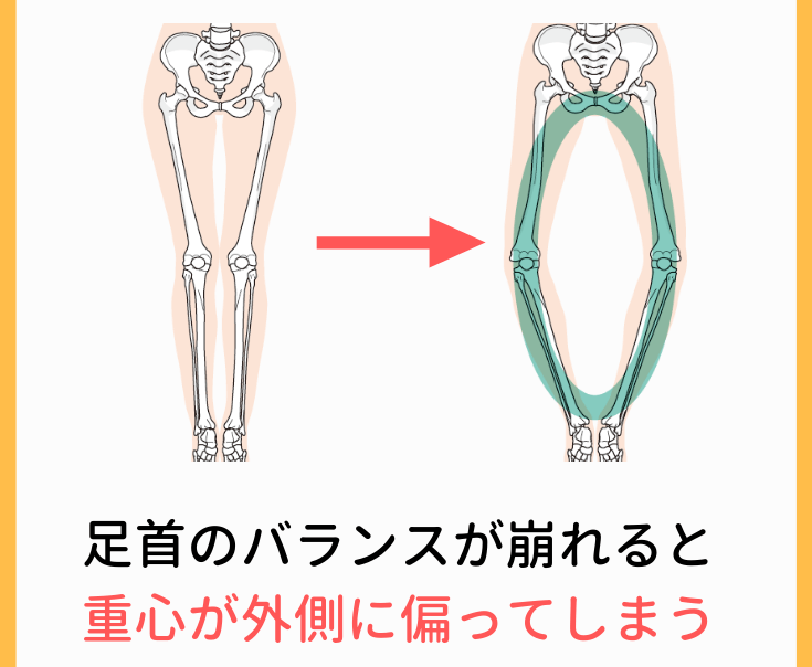 股関節のバランスの崩れ