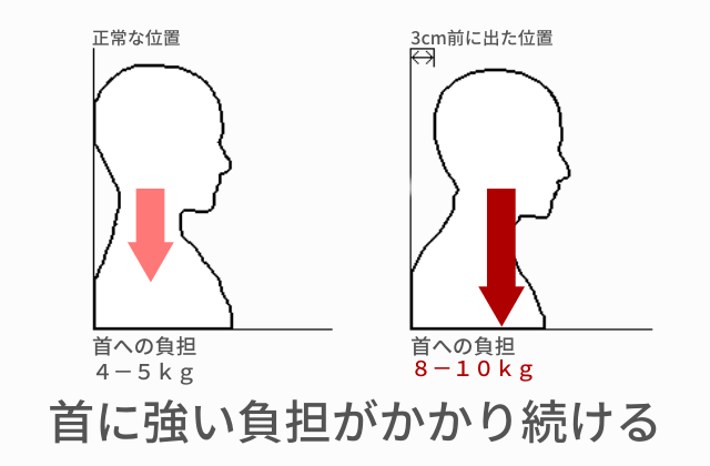 頭が前に突き出た悪い姿勢