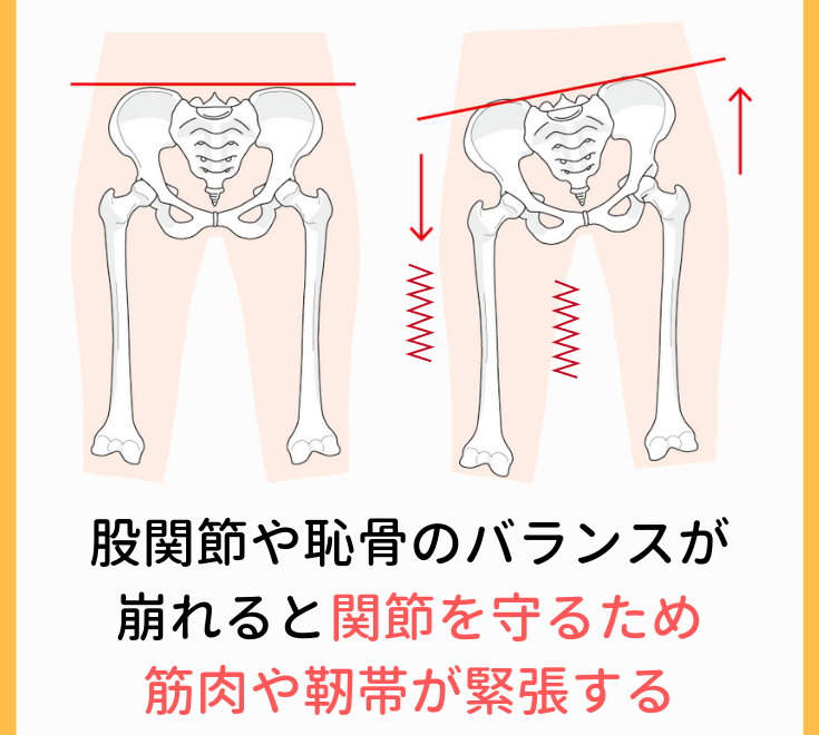 股関節のバランスの崩れ